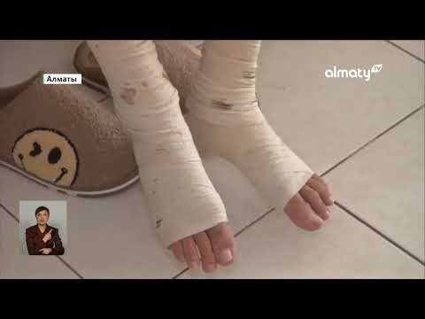 Видео: Чудом выжил: врачи спасли пациента с 80% ожога тела