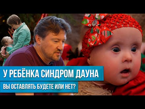 Видео: УНИКАЛЬНЫЙ СЛУЧАЙ! РОДИТЕЛИ ИЗ РЕБЕНКА С СИНДРОМОМ ДАУНА ВЫРАСТИЛИ МАЛЕНЬКОГО ГЕНИЯ