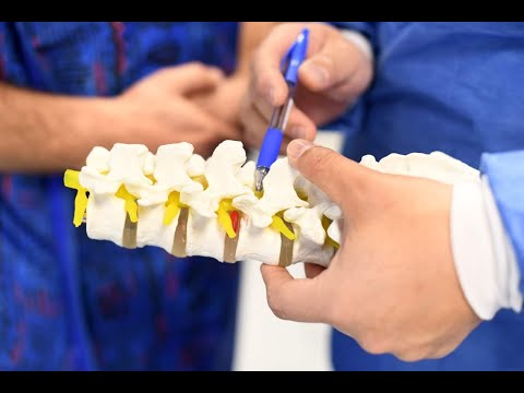 Видео: Первичные опухоли позвоночника.