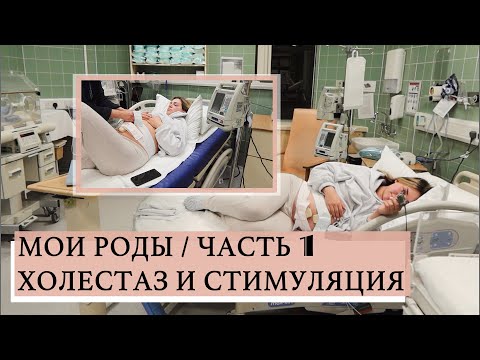 Видео: МОИ РОДЫ | СТИМУЛЯЦИЯ | ПАРТНЁРСКИЕ РОДЫ