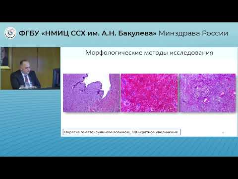 Видео: Защита диссертации Симонян Т. А.