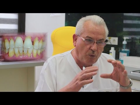 Видео: ПАРОДОНТОЗ и ПАРОДОНТИТ. Причины возникновения