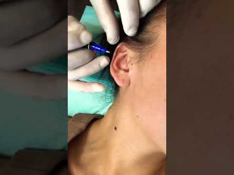 Видео: Почему бы и нет 😉✌🏼 Сразу 5 проколов !