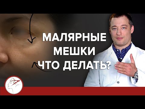 Видео: Малярные мешки. Что делать? (18+)