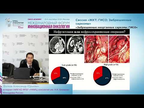 Видео: Доклад Факторы прогноза и алгоритмы хирургического лечения при забрюшинных липосаркомах.