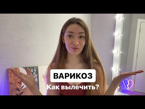 Видео: ВАРИКОЗ🦵🏼Что делать и как лечить?