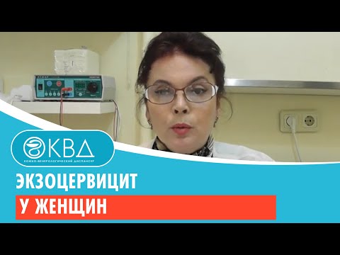 Видео: 👩 1492  Экзоцервицит у женщин