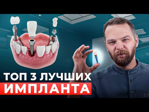 Видео: ТОП-3 зубных имплантов