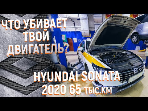 Видео: Повышенный расход масла G4NA Hyundai Sonata 2020
