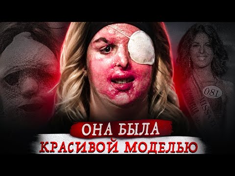 Видео: Из будущей звезды — в инвалида...