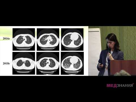 Видео: Путь к диагнозу. Дифференциальный диагноз взрослого пациента с первичным иммунодефицитом