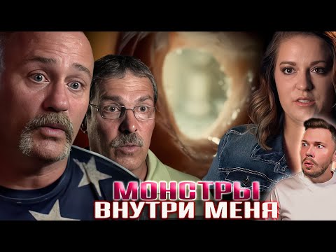 Видео: Монстры внутри меня ► Выросла вторая голова ► Сезон 7 / 5