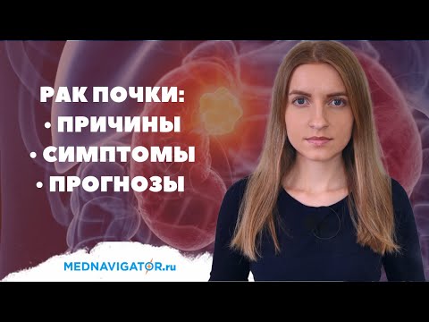 Видео: Вся правда о РАКЕ ПОЧКИ | Причины, симптомы, прогноз опухолей почек | Mednavigator.ru