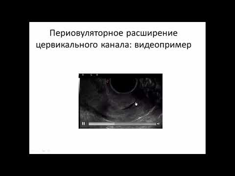 Видео: УЗИ патологии шейки матки.Видеолекция.