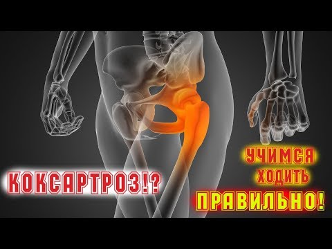 Видео: КОКСАРТРОЗ! Учимся ХОДИТЬ ПРАВИЛЬНО! ТРЕНЕР ХАПАЕВ