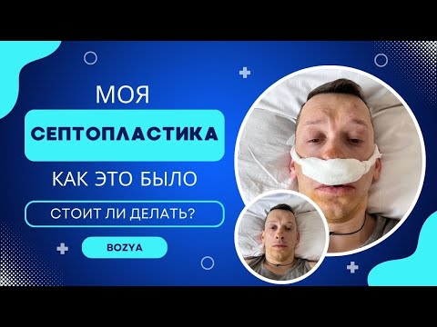 Видео: Моя СЕПТОПЛАСТИКА. КАК это БЫЛО. Стоит ли ДЕЛАТЬ?