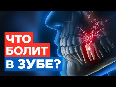 Видео: Строение зуба / Как болят разные части зуба, и сколько стоит лечение?