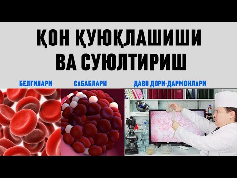 Видео: ҚОН ҚУЮҚЛАШИШИ БЕЛГИЛАРИ, САБАБЛАРИ ВА УЙ ШАРОИТИДА ДАВО ЧОРАЛАРИ / ИНФАРКТ ВА ИНСУЛЬТ ОЛДИНИ ОЛИШ
