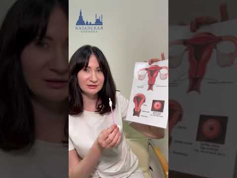 Видео: Онкоцитология