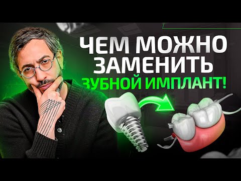 Видео: Чем заменить зубной имплант? Альтернатива имплантации зубов в 2024