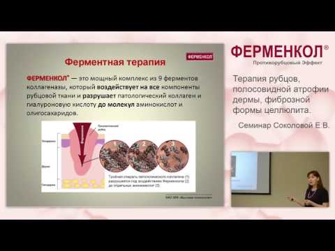 Видео: Терапия рубцов, полосовидной атрофии дермы (стрии/растяжки), фиброзной формы целлюлита с Ферменкол