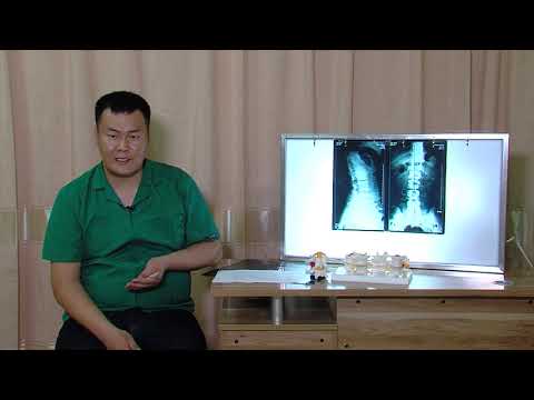 Видео: "Эмчийн цаг" нэвтрүүлэг Нурууний мурийлт