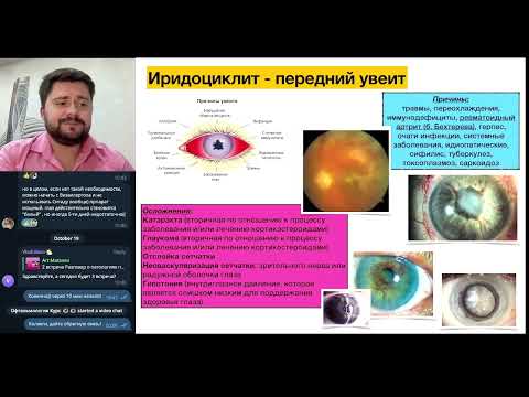 Видео: Иридоциклит - демо превью-видео из нашего курса Фундаментальная офтальмология