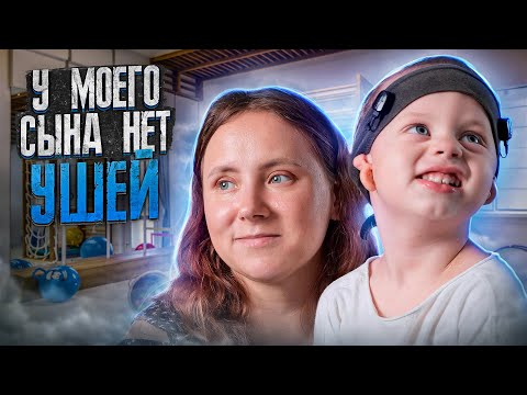 Видео: У моего сына нет ушей / Микротия
