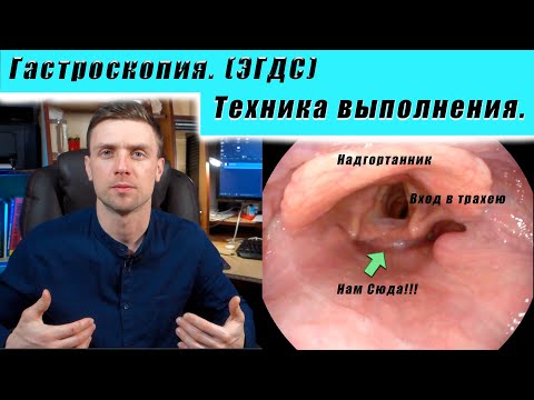 Видео: Гастроскопия +биопсия. Реальное видео. как делать? Как вводить гастроскоп?  Техника выполнения.
