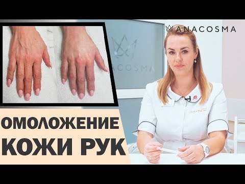 Видео: ОМОЛОЖЕНИЕ РУК ✋ ВЕНЫ И ПЯТНА НА РУКАХ КАК УБРАТЬ?