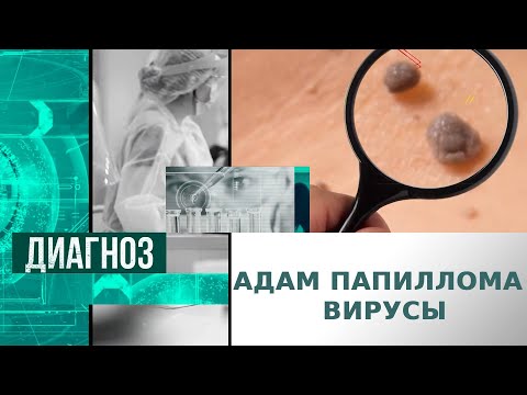 Видео: Адам папиллома вирусы қалай білінеді? | Диагноз