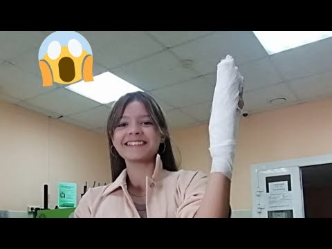 Видео: Волейбол и сломанный палец.