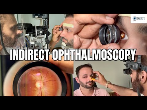 Видео: Непрямая офтальмоскопия
