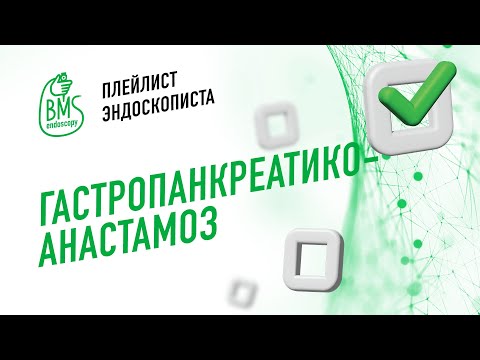 Видео: 🟢Гастропанкреатикоанастамоз под ЭУС-контролем #playlistэндоскописта клинический случай #эус #эндоузи