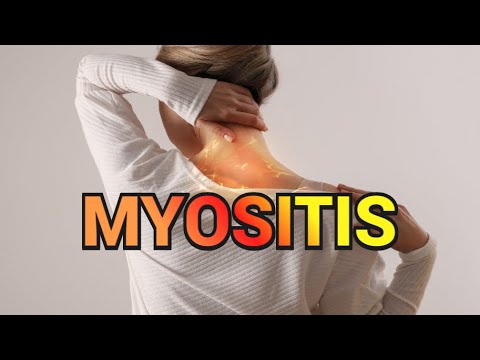 Видео: Миозит (обновлено в 2023 г.) — серия медицинских обзоров CRASH!