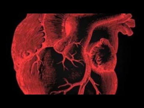 Видео: Коронарография и стентирование.Как проходит и что важно знать.