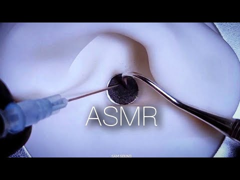 Видео: ASMR Интенсивная очистка ушей со стимуляцией и покалыванием❤️