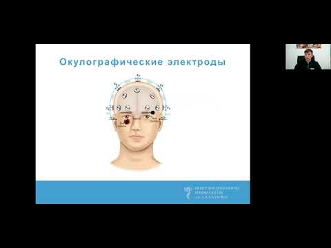 Видео: Опыт использования дополнительных электродов при продолженном видео-ЭЭГ мониторинге. Троицкий А.А.