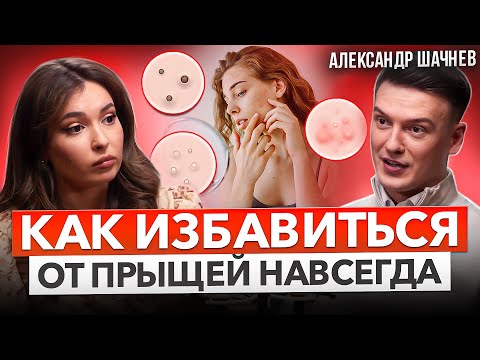 Видео: ПОДКАСТ НА ЧИСТУЮ КОЖУ: Акне и прыщи на лице - лечение, причины. 7 советов врача дерматолога.