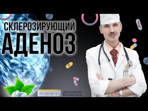 Видео: Склерозирующий аденоз молочной железы. Диагностика и лечение.
