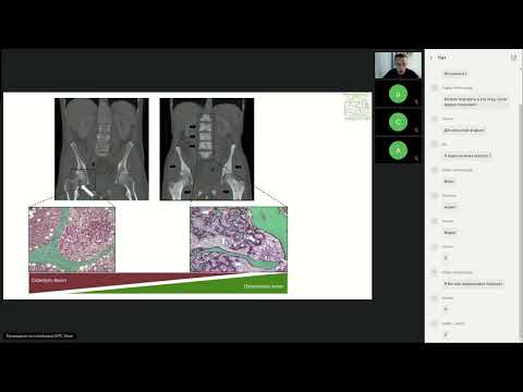 Видео: Разбор вопросов RUSSCO, 2024