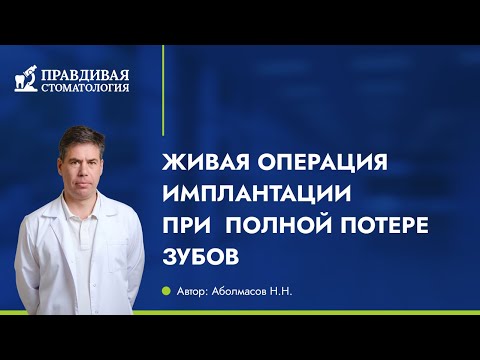 Видео: Одномоментная имплантация. Немедленная нагрузка. Перекрывающие протезы. Overdenture.