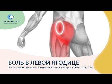 Видео: Болит левая ягодица. Возможные причины и что делать.