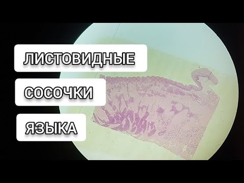 Видео: ЛИСТОВИДНЫЕ сосочки языка