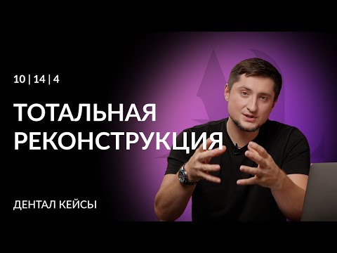 Видео: Пример работы с тотальной реконструкцией | Артур Лукьяненко
