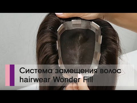 Видео: Система замещения волос Wonder Fill при женской алопеции