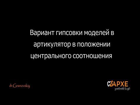 Видео: Гипсовка в артикулятор