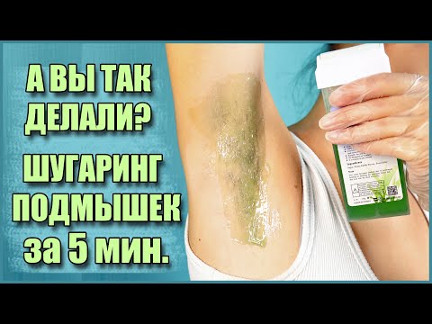 Видео: А вы так делали? Шугаринг подмышек картриджем за 5 минут!