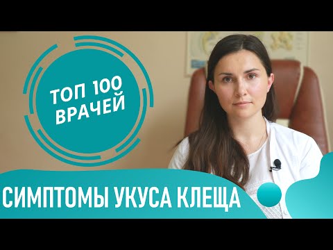 Видео: УКУС КЛЕЩА: симптомы и признаки у человека. Как выглядит место укуса клеща (фото 1-7)