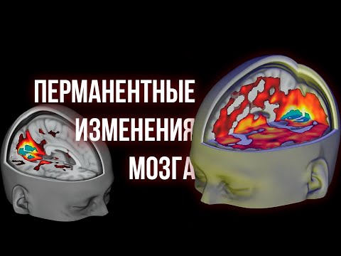 Видео: ПСИХОДЕЛИКИ ч.3 [Изменения в мозге и личности, применение в медицине]